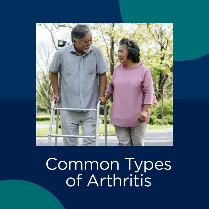 Arthritis isn’t one single condition; it can affect people in different ways and